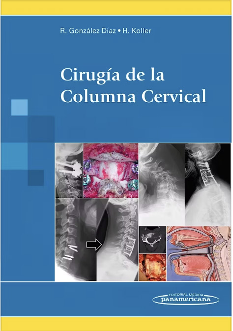 libro cirugia de la columna cervical